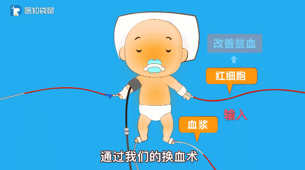 宝宝黄疸值多高要住院？在家怎么退黄快？
