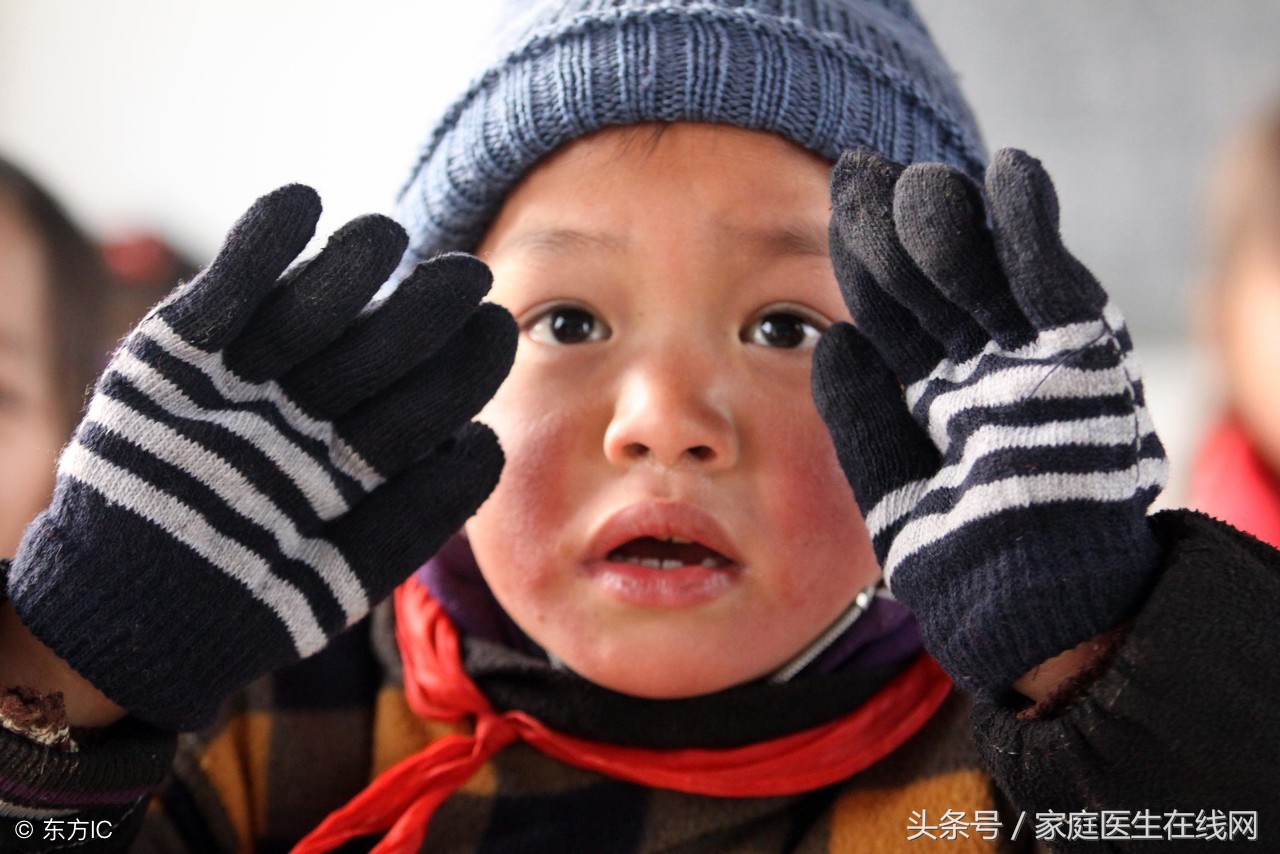 为什么冻疮容易反复发作？得了冻疮首先应该这么做！