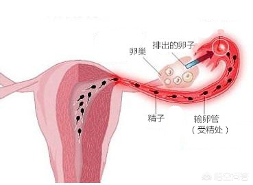 什么是输卵管通水，输卵管通水后多久能同房