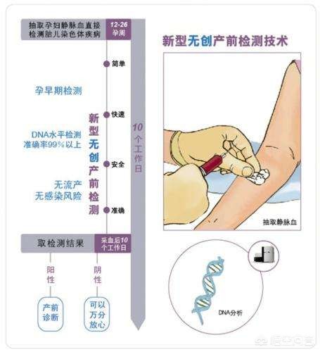 无创DNA检测通过了却生了唐氏儿， 什么是无创DNA检查