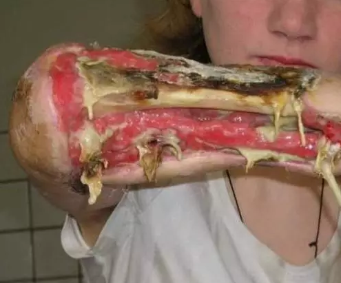 化学名为二氢去氧吗啡,是一种可待因和碳氢化合物组成的混合物.