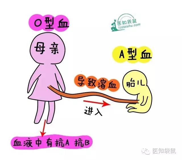 爸妈“血型不合”竟然对宝宝有这么大影响！