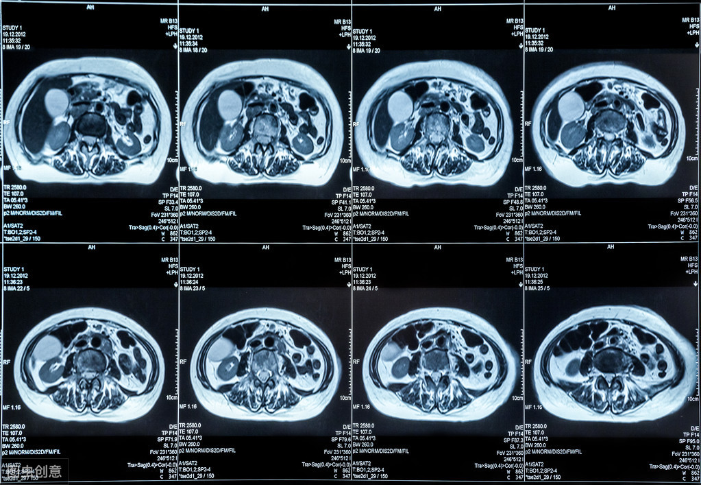 医生都喜欢给病人做CT？辟谣：CT有辐射，做不做看必要性