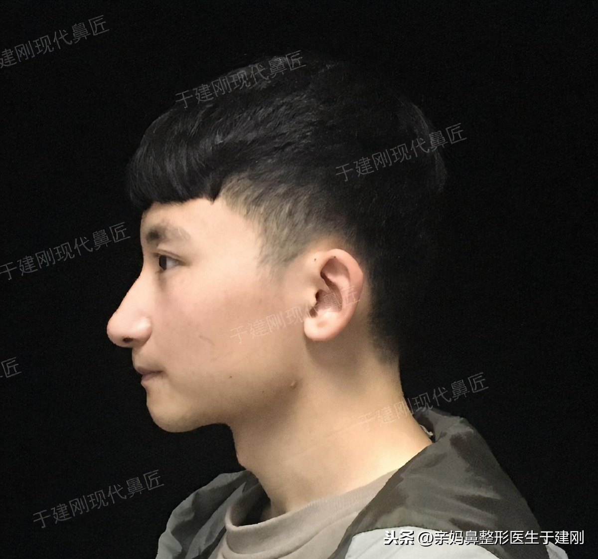 鼻头下垂的男人图片