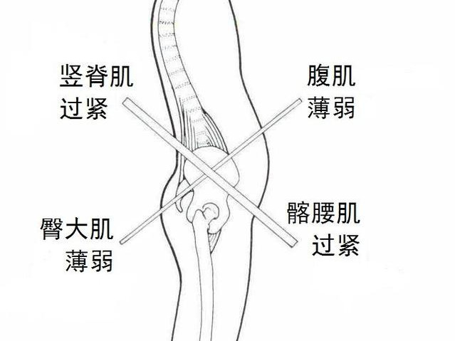 为什么久坐总是腰酸背痛？练好这个动作拯救你的骨盆前倾