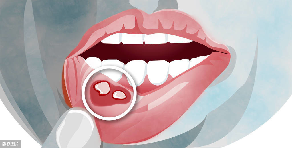 主要诊治口腔黏膜,包括唇,颊,舌,牙龈,腭部等部位的疾病