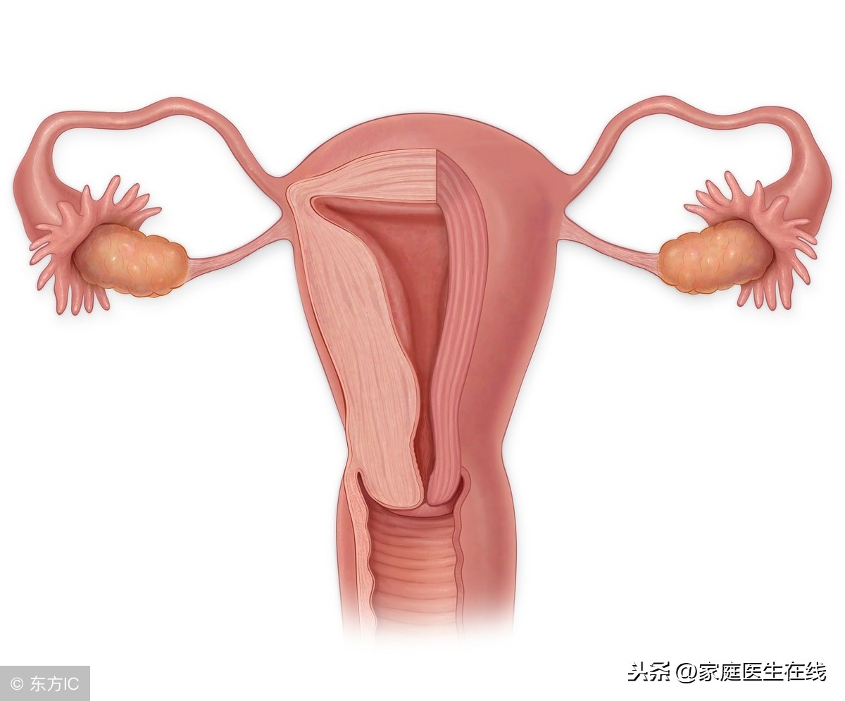 子宫息肉要做手术吗？病情较轻的女性，日常调理要记得做好3件事