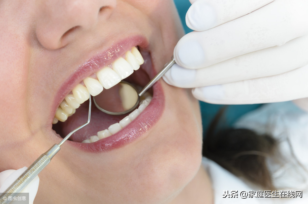 90后因牙周炎拔掉半口牙？医生感叹：牙周炎的危害不可小觑