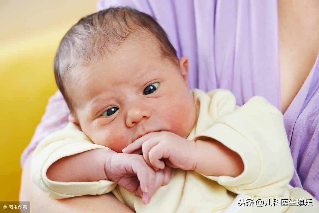 婴儿斗鸡眼怎么办 怎样预防斗鸡眼的发生