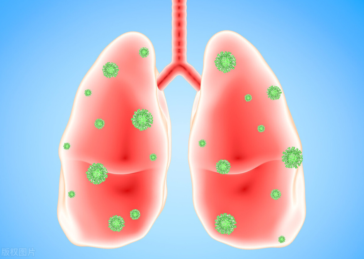 呼吸性细支气管炎间质性肺病的病因和应该做的检查？-京东健康