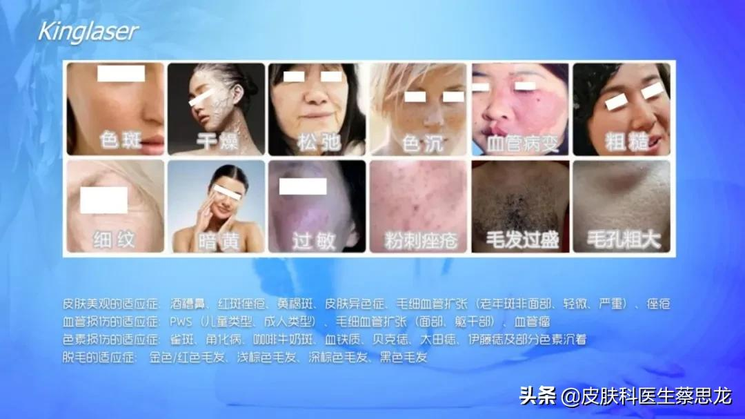 一文读懂|光子嫩肤全解析