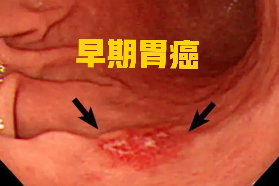 肝膽脾胰腎彩超多少錢(同學父親腹痛消瘦做胃鏡) - 價格百科