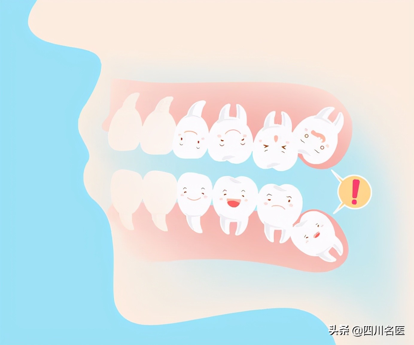智齿到底要不要拔？一次拔几颗？什么时候拔？终于讲清楚了