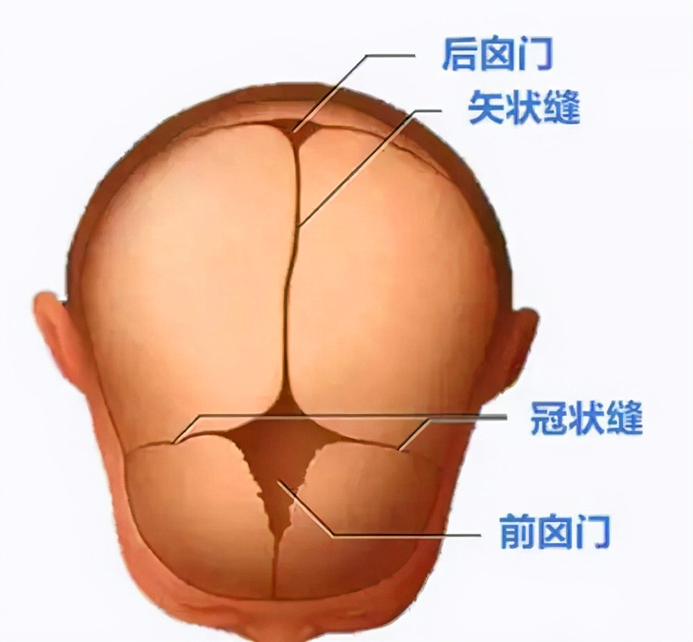 睡姿不当会导致新生儿头骨变形，不少新手妈妈还不懂，及时纠正