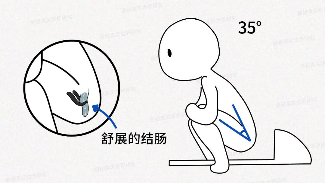 卧床大便姿势图片(掌握2个特殊的排便姿势) - 赤虎壹号