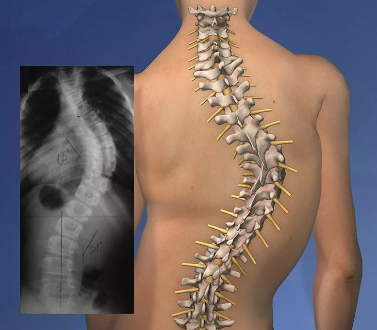 后背疼痛是怎么回事？可能和4种病有关，符合3种情况要及时就诊