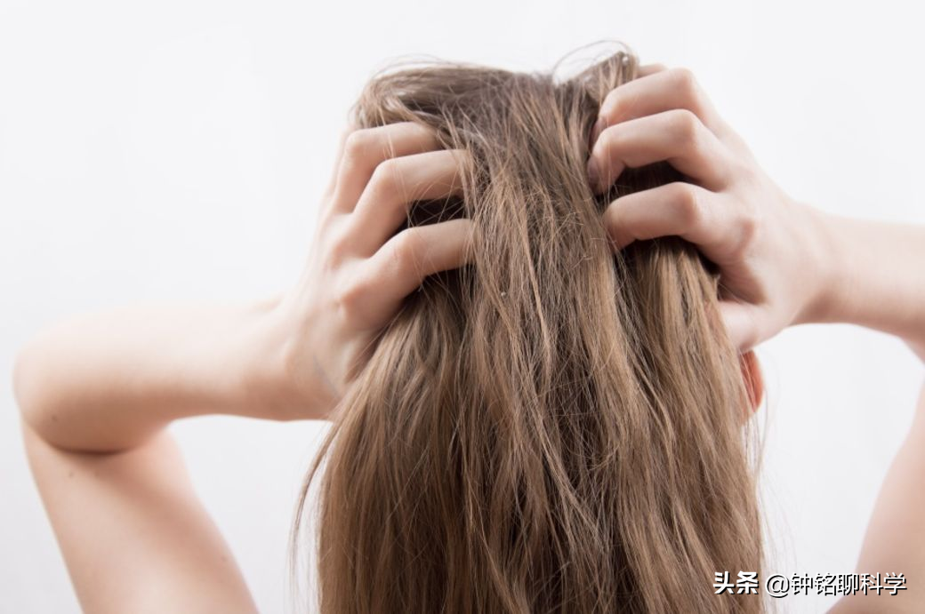 同人类共演化，解开人类“褪毛之谜”的虱子，现如今怎么消失了？