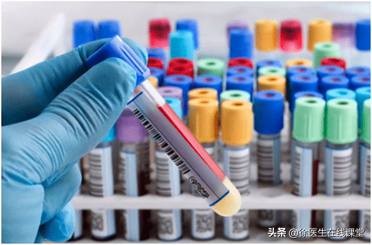 血脂高怎么办？必须吃药吗？别着急，先试试这些办法，降低胆固醇