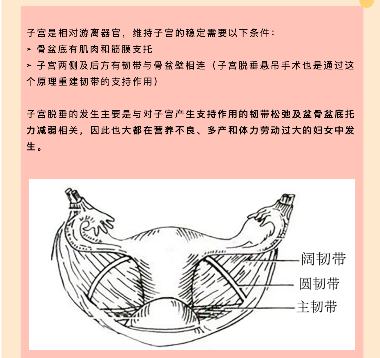 产后小腹总有下坠感，要警惕子宫脱垂啦