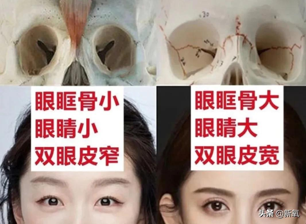 姐妹,双眼皮再好,咱也别硬割啊