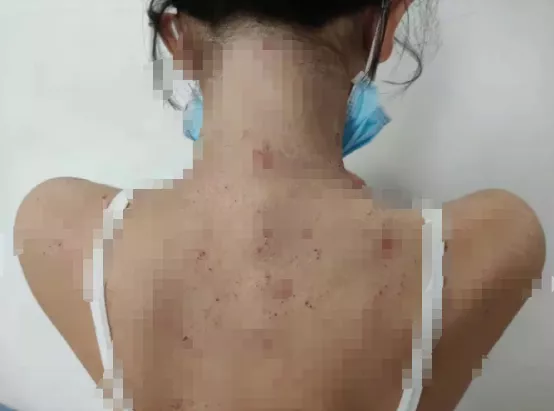 18女的下面流水图片欣赏(12岁女孩患) - 赤虎壹号