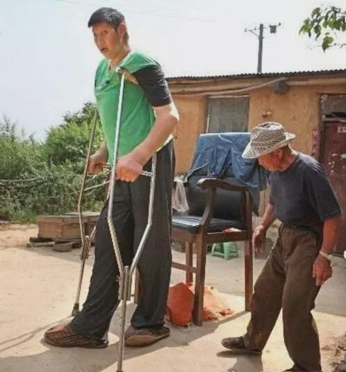 亚洲第一巨人王峰军，中国十大巨人排行榜