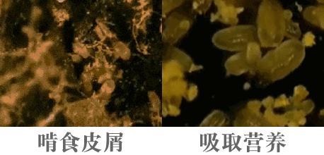 脸上泛红发痒、出油长痘？“螨虫脸”真的很丑，除螨刻不容缓