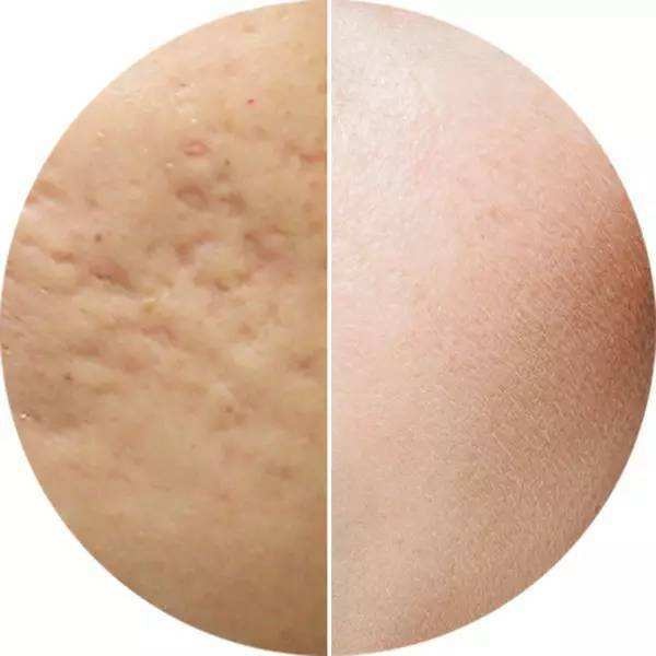 想要皮肤白，“娃娃”留下来，细说黑脸娃娃和白瓷娃娃