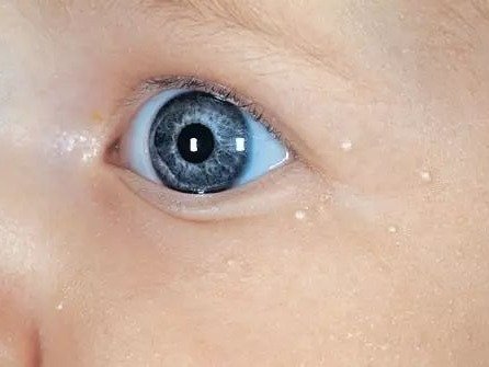 婴儿脸上长藓图片(15种婴儿常见皮肤病详解)-幼儿百科-魔术铺