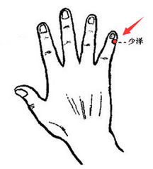 神奇的刺血疗法系列之少泽放血