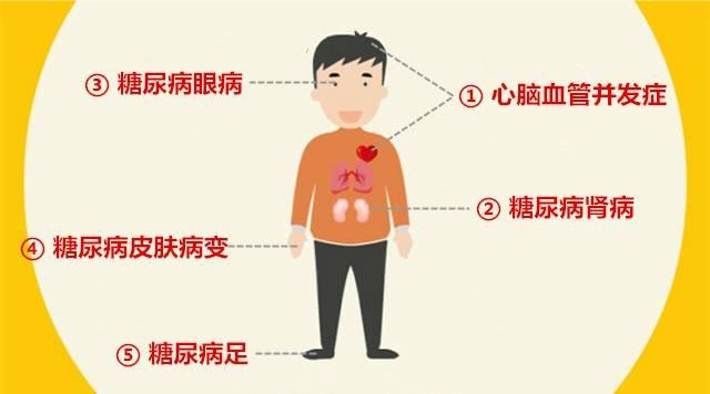 “斜视”不全是眼睛的问题，也可能是神经系统出了毛病