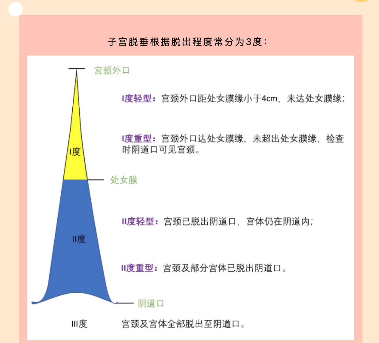 产后小腹总有下坠感，要警惕子宫脱垂啦