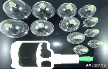 健康科普堂 | 拔罐讲义