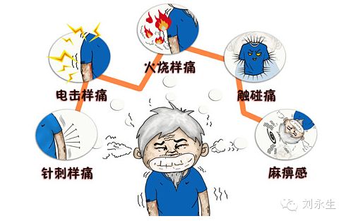 头部一跳一跳的痛就是“神经性头痛”？看医生为你分析