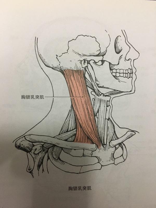 孩子經常歪著脖子,這不是賣萌,家長要警惕1種病:小兒肌性斜頸