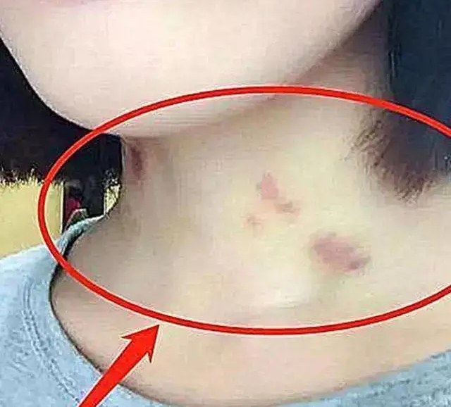 孩子早恋问题多，易发生这三种危害，特别是第三种对孩子伤害大