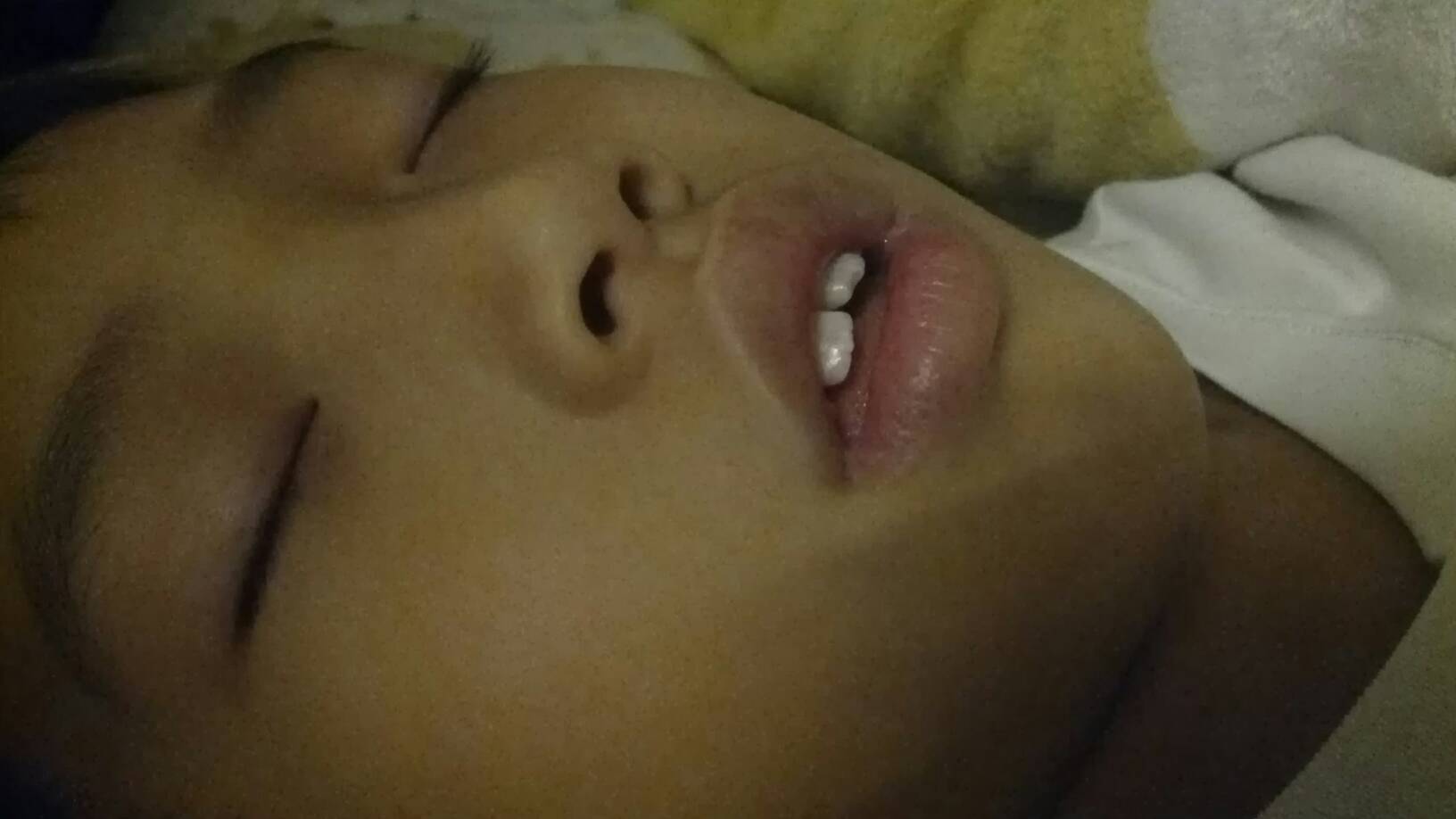 张嘴呼吸会变丑图片(宝妈对比孩子3年前照片) - 赤虎壹号