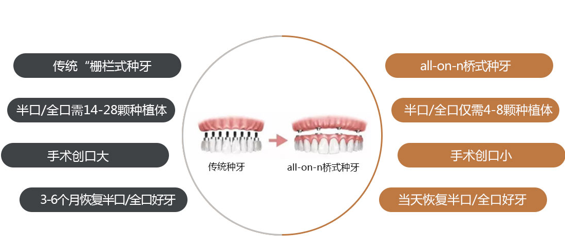 高龄老年人种牙，需要知道的事