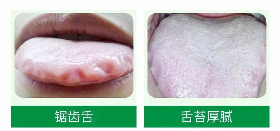 十大天然祛湿药材，帮你轻松排走体内顽固湿气