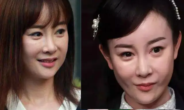 娱乐圈10位被整容毁掉的女星，有人脸僵如石，有的命丧手术台