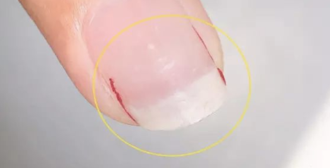 做美甲多久后必须要卸甲？一定要去美甲店卸甲吗？