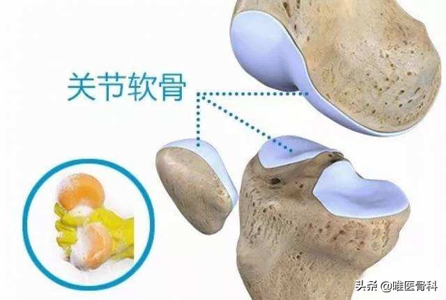 氨基葡萄糖是不是药品？需要凭处方买吗？别再被骗了