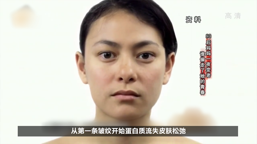 20歲女子一夜之間容貌衰老到80歲，被兒子疏遠後一心求死，紀錄片