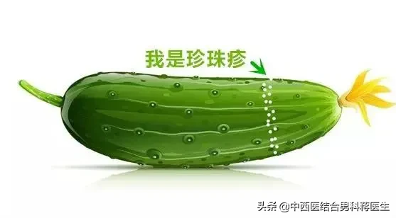 龟头长了1串像珍珠一样的东西：医生来告诉你这是啥东西？