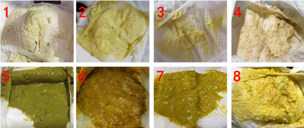 新生儿吐的胆汁图片(这种病专盯刚出生的小宝宝) - 赤虎壹号