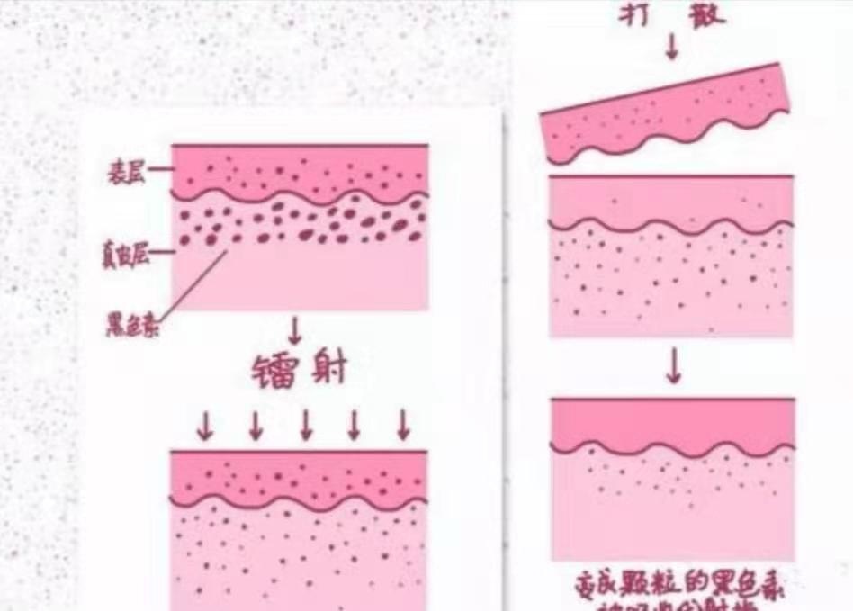 想要皮肤白，“娃娃”留下来，细说黑脸娃娃和白瓷娃娃