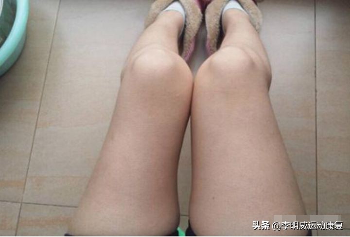 健行者：膝盖疼痛，如何有效保养康复？