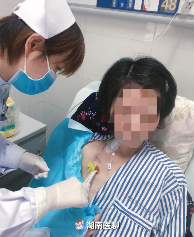 我为群众办实事|输液港植入 营养管理,为无法进食患者解难题