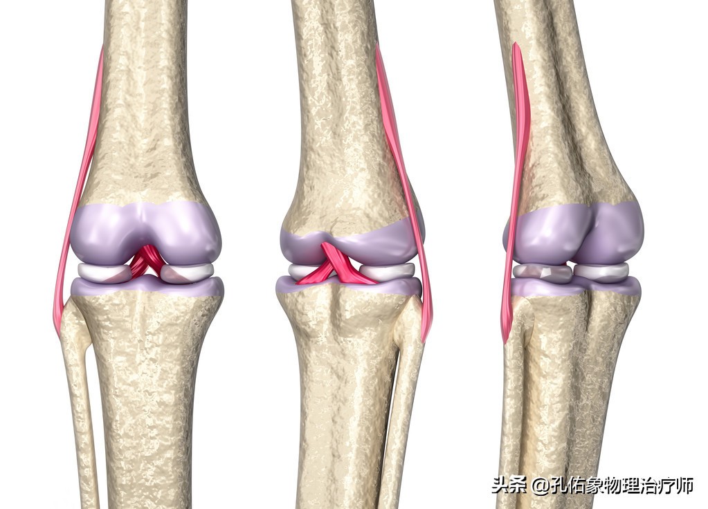 膝盖疼痛，这个病因是罪魁祸首！常被忽视，如何治疗，医生告诉您
