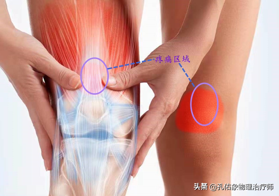 膝关节在下蹲、上下楼梯疼，还会响，为何？盘点6个原因，请收藏